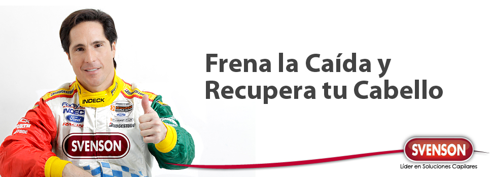 Tratamientos para detener la caida, Mexico
