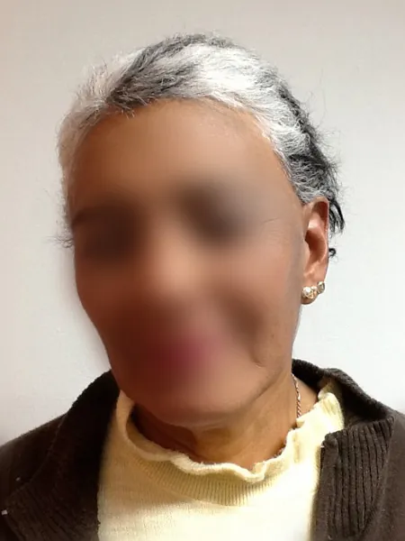 Caso 4: después del tratamiento