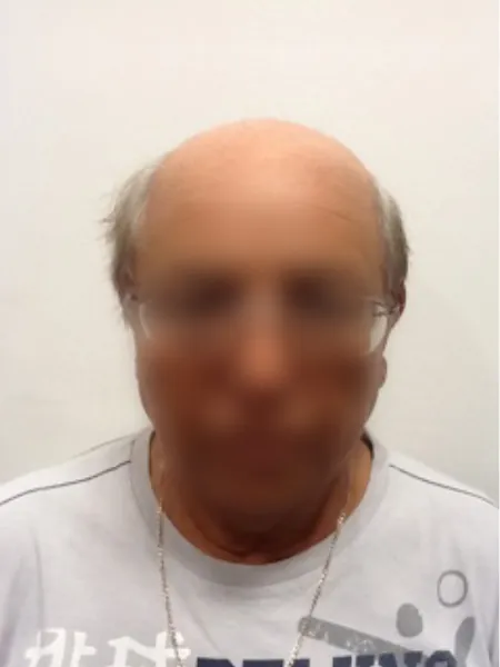 Caso 9: antes del tratamiento