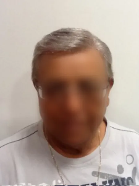 Caso 9: después del tratamiento