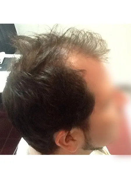 Caso 7: antes del tratamiento