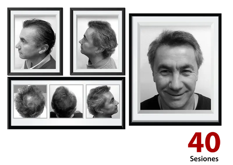 Detener caída cabello