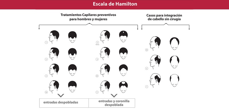Escala de Hamilton